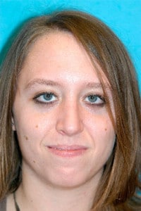 Rhinoplasty (Nose Job) Before and After Photos